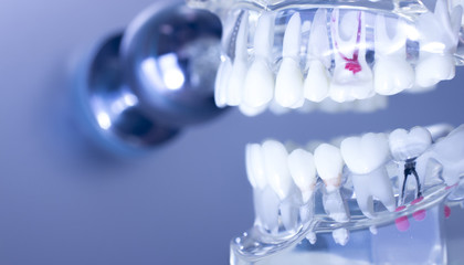 Dental teeth mouth model