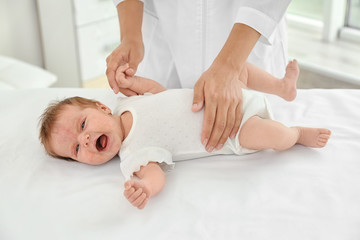 Fototapeta na wymiar Adorable baby with skin allergy lying on table in hospital