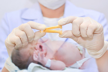 Double exposure of close up of doctor holding yellow umbilical cord clamp used to clamp off the umbilical cord after a baby's birth.