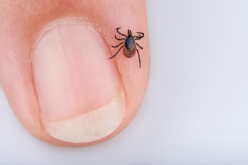Detail of tick on human fingertip. Ixodes ricinus. Dangerous parasite and carrier of infection such as encephalitis and borreliosis.