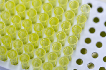 Backgrounds of tip for pipette in Lab.