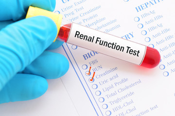Blood sample with requisition form for renal function test