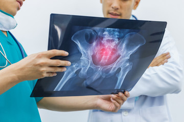 Two doctors are diagnosing the symptoms of a patient from x-ray at hip bone. concept of medical...