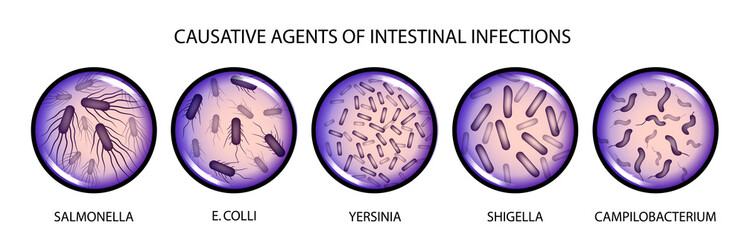 the causative agents of intestinal infections