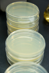 Close-up detail of stacks of agar plates inoculated with various bacteria in a laboratory, for...