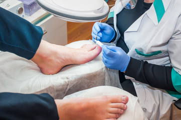 Podology treatment. Podiatrist treating toenail fungus. Doctor removes calluses, corns and treats...