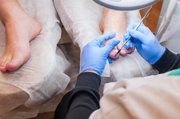 Podology treatment. Podiatrist treating toenail fungus. Doctor removes calluses, corns and treats ingrown nail. Hardware manicure. Health, body care concept. Selective focus