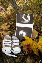 A baby`s ultrasound and baby shoes placed on autumn leaves 