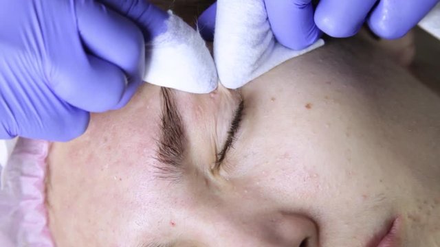 beautician squeezing pimple blackheads for young wonan in beauty salon. facial skin care