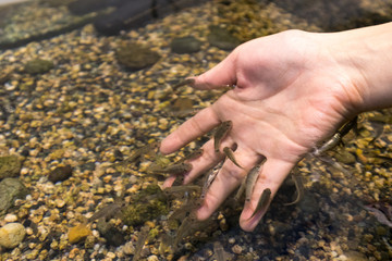 doctor fish and hand