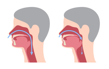 Obraz premium a snoring infographic / vector