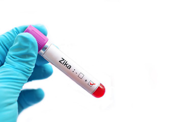 Obraz premium Blood sample positive with Zika virus