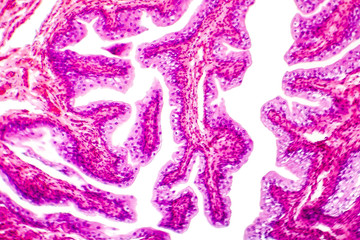 Transitional epithelium tissue of the urinary bladder under microscope, light micrograph, hematoxylin eosin staining