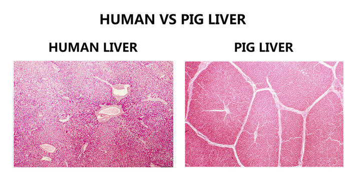 Human and pig liver histology. Comparison of light photomicrographs showing presence of well demarkated interlobular septae from connective tissue in pig liver in contrast to human liver