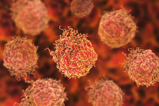 Prostate cancer cells, 3D illustration. Prostate cancer awareness image