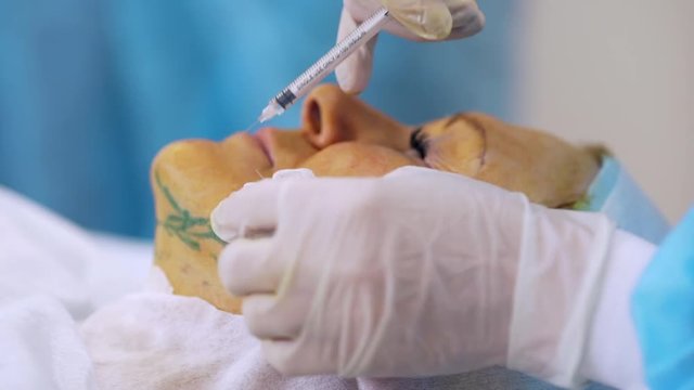 picture of surgeon making injection in face with markings of adult woman 50s-60s lying on operating table anesthetizing a patient before plastic surgery reallife closeup 