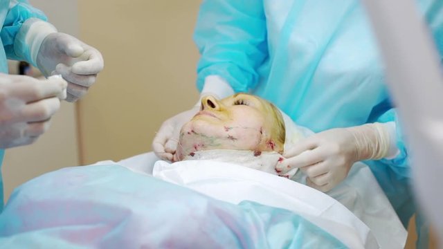 picture of team of professionals touching examining face of adult woman lying on table in operating room with closed eyes after cosmetologic procedure of rejuvenation cutting off medical threads