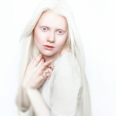 Albino girl with white skin, natural lips and white hair. Photo face on a light background. Portrait of the head. Blonde girl
