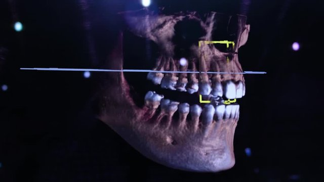 3D dental digital modeling restoration. 3d model of teeth, scanned teeth of the patient. The doctor is studying the tooth