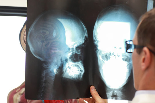 Medical professional comparing  x-ray images of skull  with functional model 