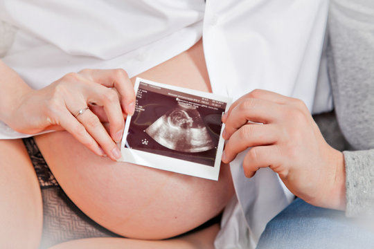The hands of the father and mother hold a picture of an ultra sound study