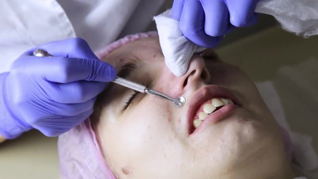 beautician squeezing pimple blackheads from nose with pimple popper tool