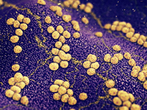Colony of Staphylococcus aureus bacteria causing skin infection , Antibiotic resistant infectious diseases