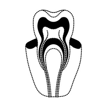 tooth with nerve and root view in black dotted silhouette