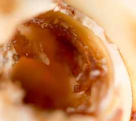 caries in the tooth. macro