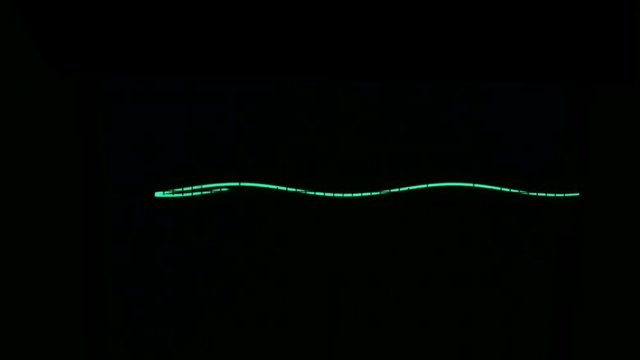 Amplitude Diagram on the oscilloscope