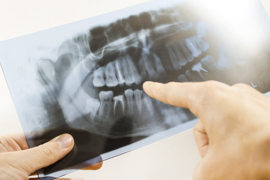 to study an x-ray of teeth