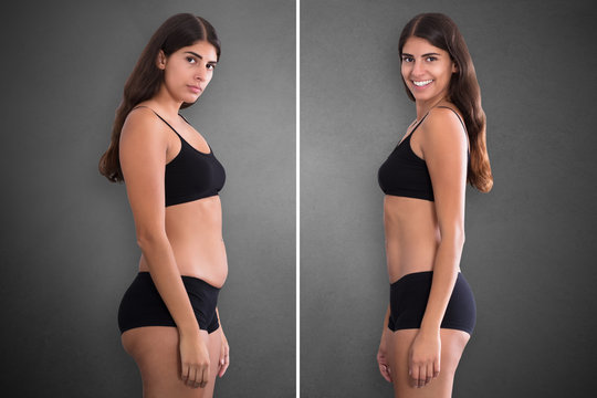 Woman Before And After From Fat To Slim Concept