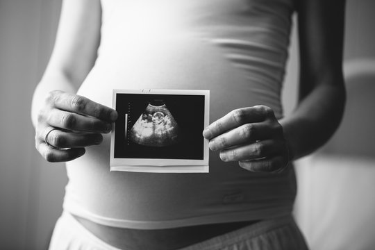 Pregnant woman holding echography of her baby.
