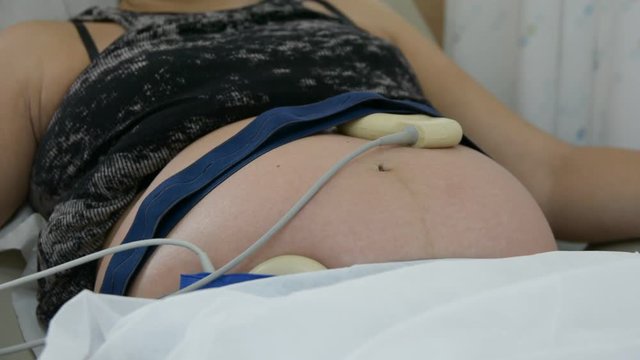 Pregnant woman in hospital with cardiotocography bell