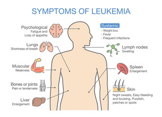 Common symptoms and signs of Leukemia. Medical illustration ideal for cancers diagram.
