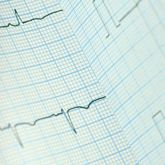 Bended ECG paper as a medical background