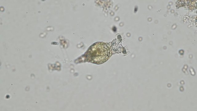 Rotifers are microscopic aquatic animals of the phylum Rotifera. Rotifers can be found in many freshwater environments and in moist soil.