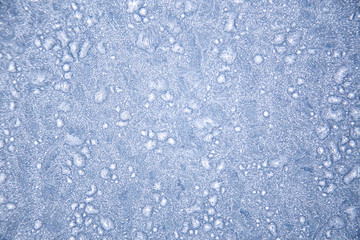frosty background