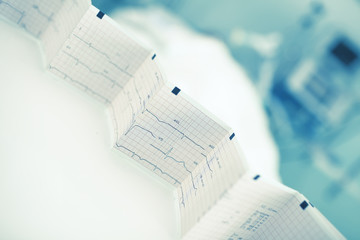 Folded ECG trace in the background of patient bed