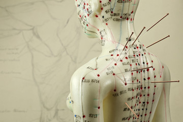 female acupuncture model with needles in the shoulder - obrazy, fototapety, plakaty