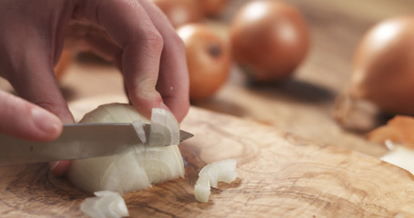 Fototapeta na wymiar young female hands slicing white onion
