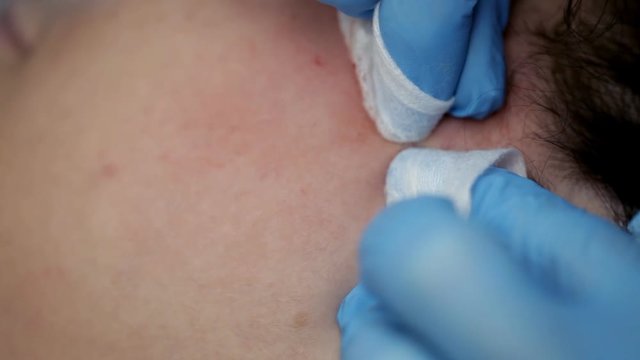 Mechanical facial cleansing in the beauty salon