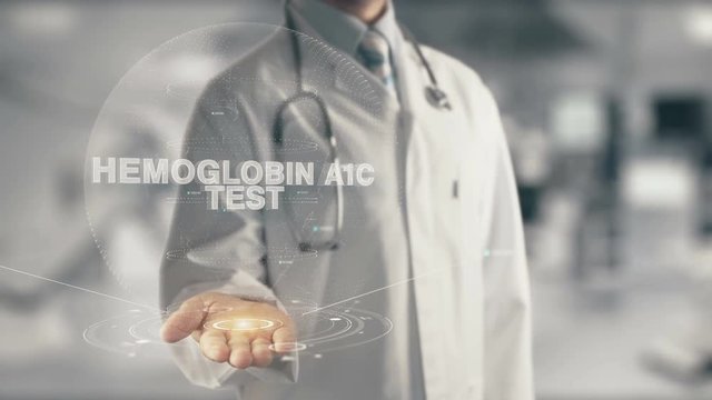 Doctor holding in hand Hemoglobin A1c Test