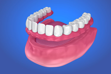 All missing teeth - removable full denture. 3D illustration