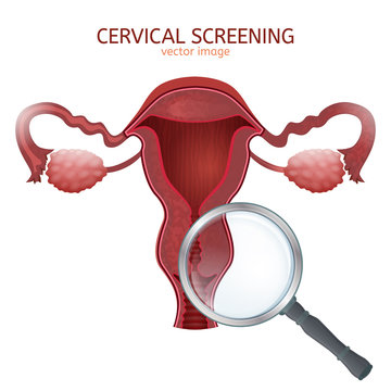 Cervical screening image