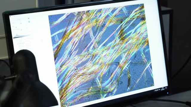 Microstructure and fibers of the specimen magnified under an electronic microscope in laboratoty display