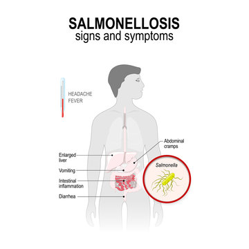 Salmonellosis. Signs and symptoms.