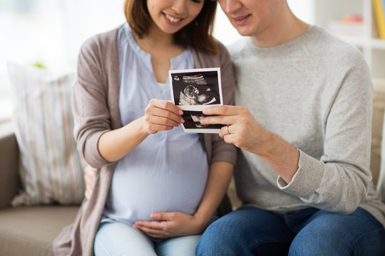 couple with baby ultrasound images at home