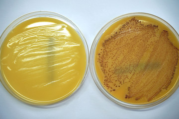 Petri dish with Staphylococcus aureus culture. MRSA test.