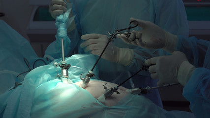 Operation using laparoscopic equipment. Surgeons team. Hospital.